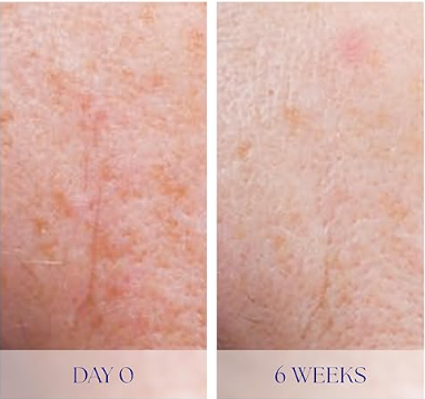 iS CLINICAL Active Serum - Helps visibly even skin tone, Excellent for acne-prone skin, Anti-Aging, Face Serum - Image 3